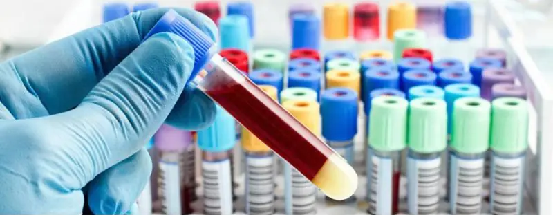 Tubes de prélèvement : formation à la prise de sang au SeminarZentrum de Berlin